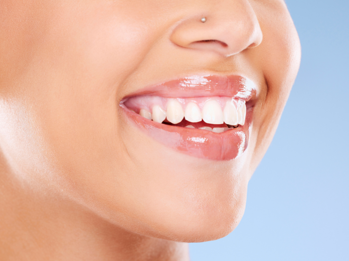 The Secret to a Celebrity-Worthy Smile